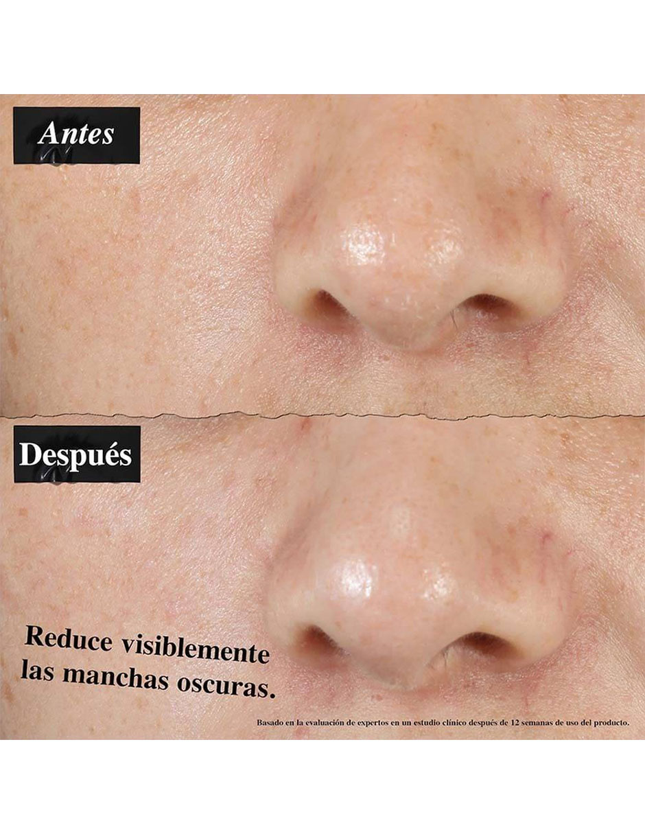 Sérum facial antimanchas Clearly Corrective Dark Spot Solution Kiehl'S todo tipo piel