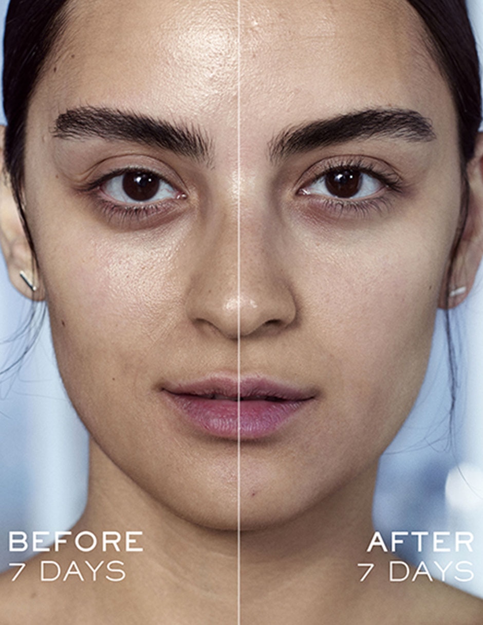 Sérum antiedad facial Génifique Lancôme todo tipo piel 13