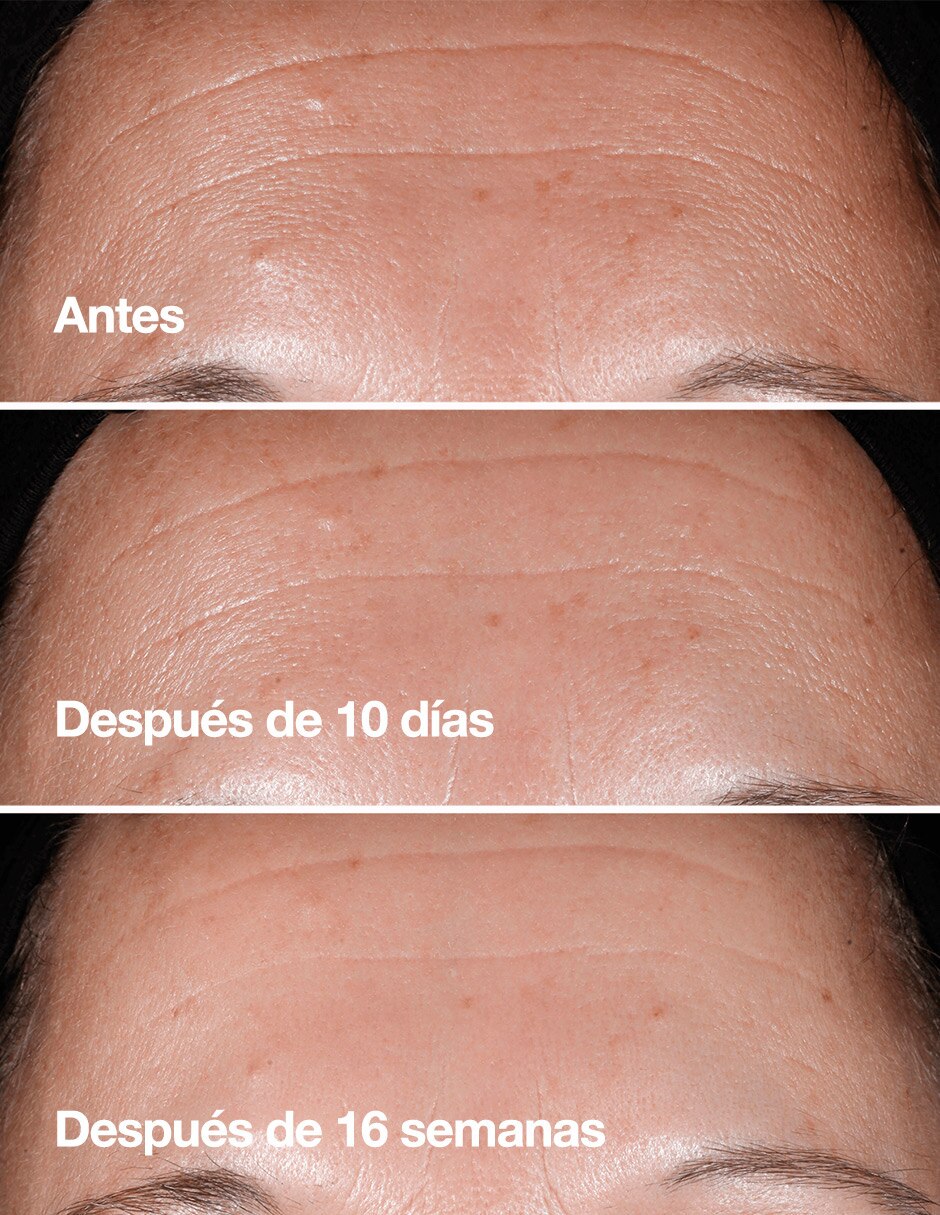 El Smart Clinical Repair 100ML 8