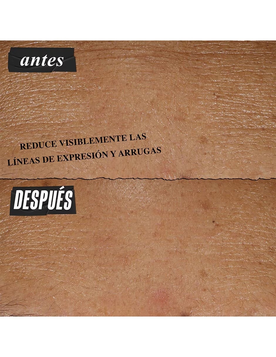 Sérum antiedad facial Retinol Skin-Renewing Daily Micro-Dose Kiehl's todo tipo piel