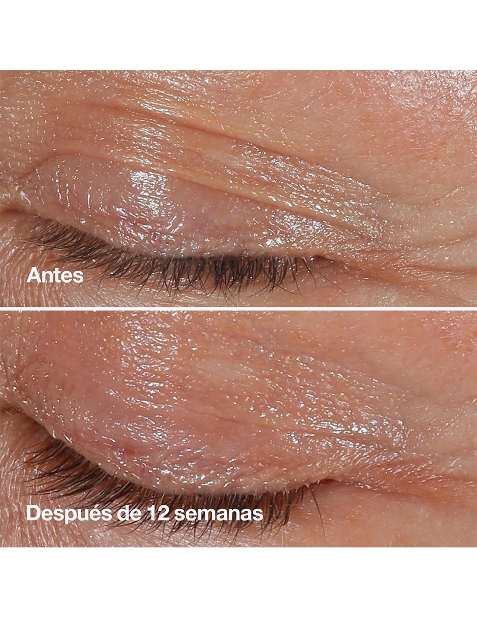 Crema para ojos recomendada para prevenir signos de la edad día y noche Clinique Smart Clinical para todo tipo piel