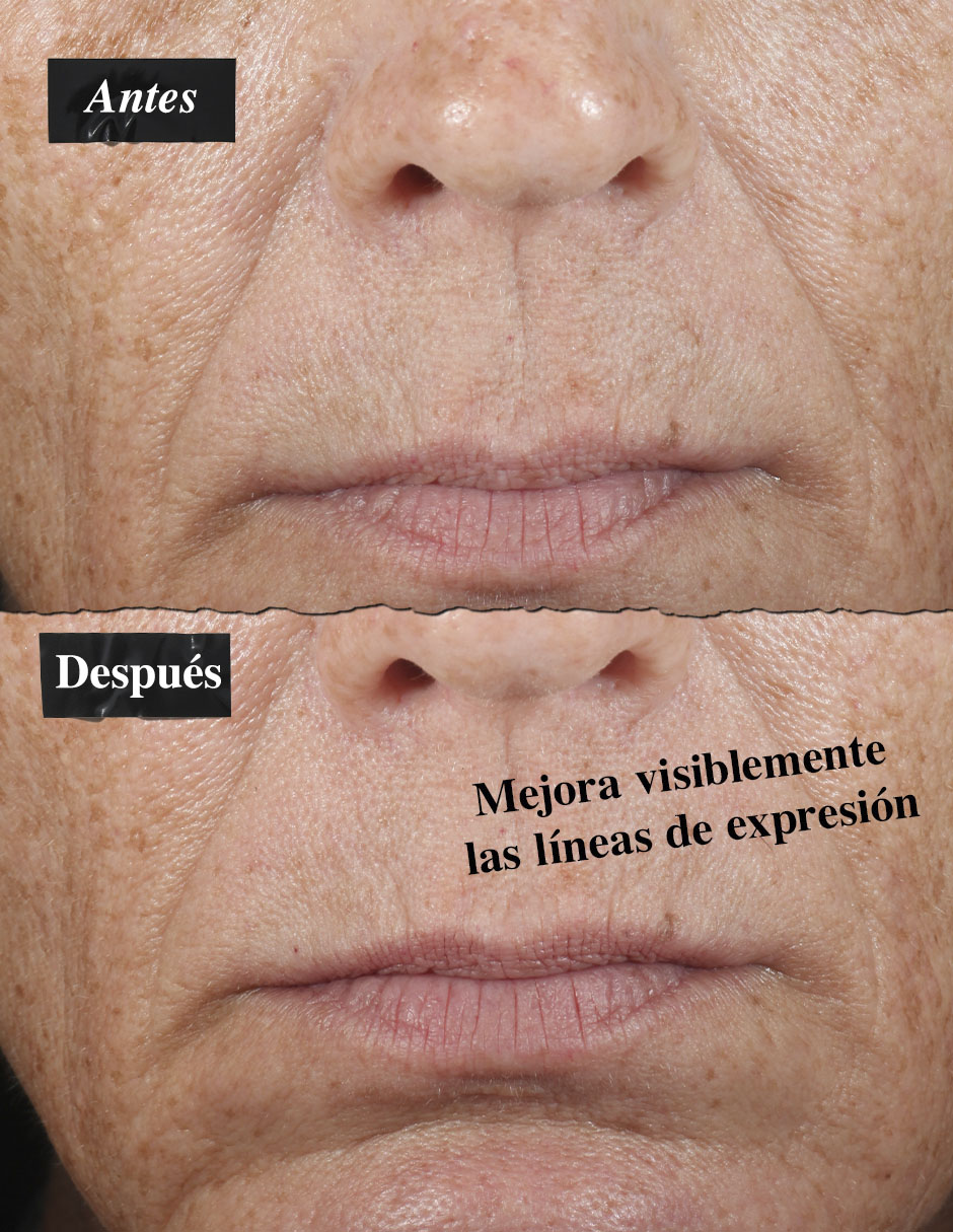 Sérum Antiedad Facial Midnight Recovery Concentrate Kiehl'S Todo Tipo Piel