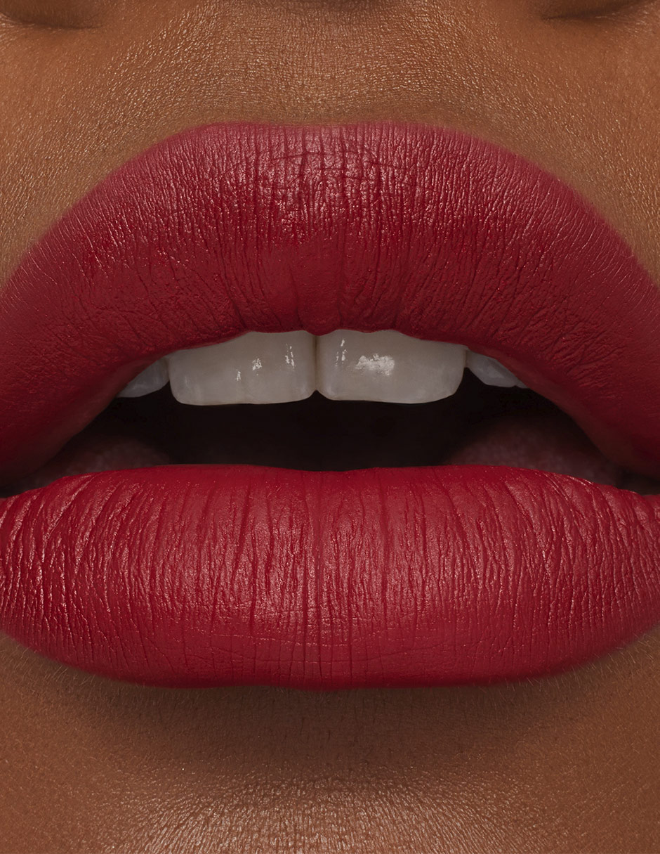 Labial mate M·A·Cximal 4