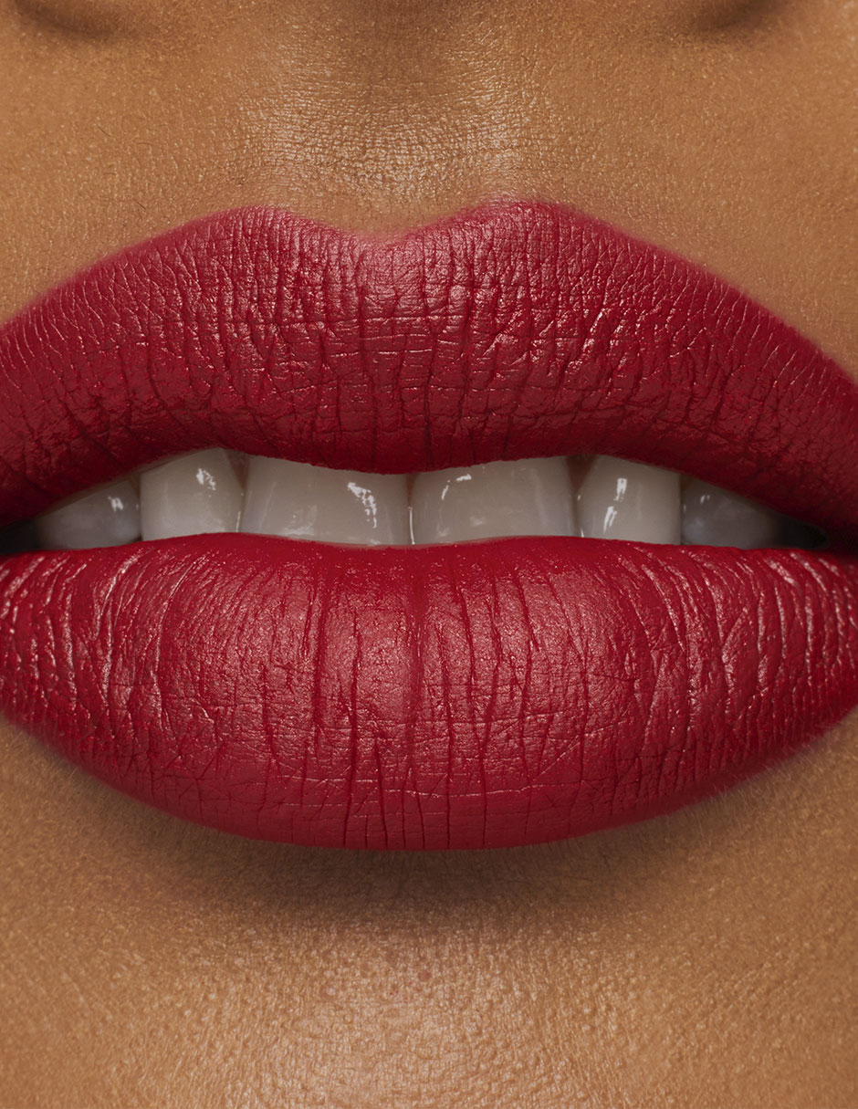 Labial mate M·A·Cximal 6