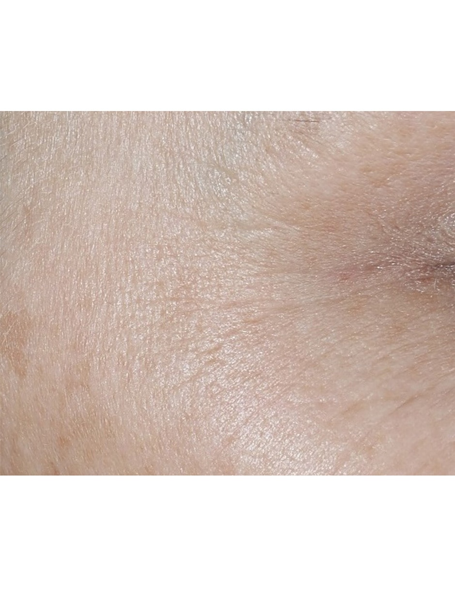 Crema facial recomendada para prevenir signos de la edad de día Smart Clinical Repair para todo tipo piel 13