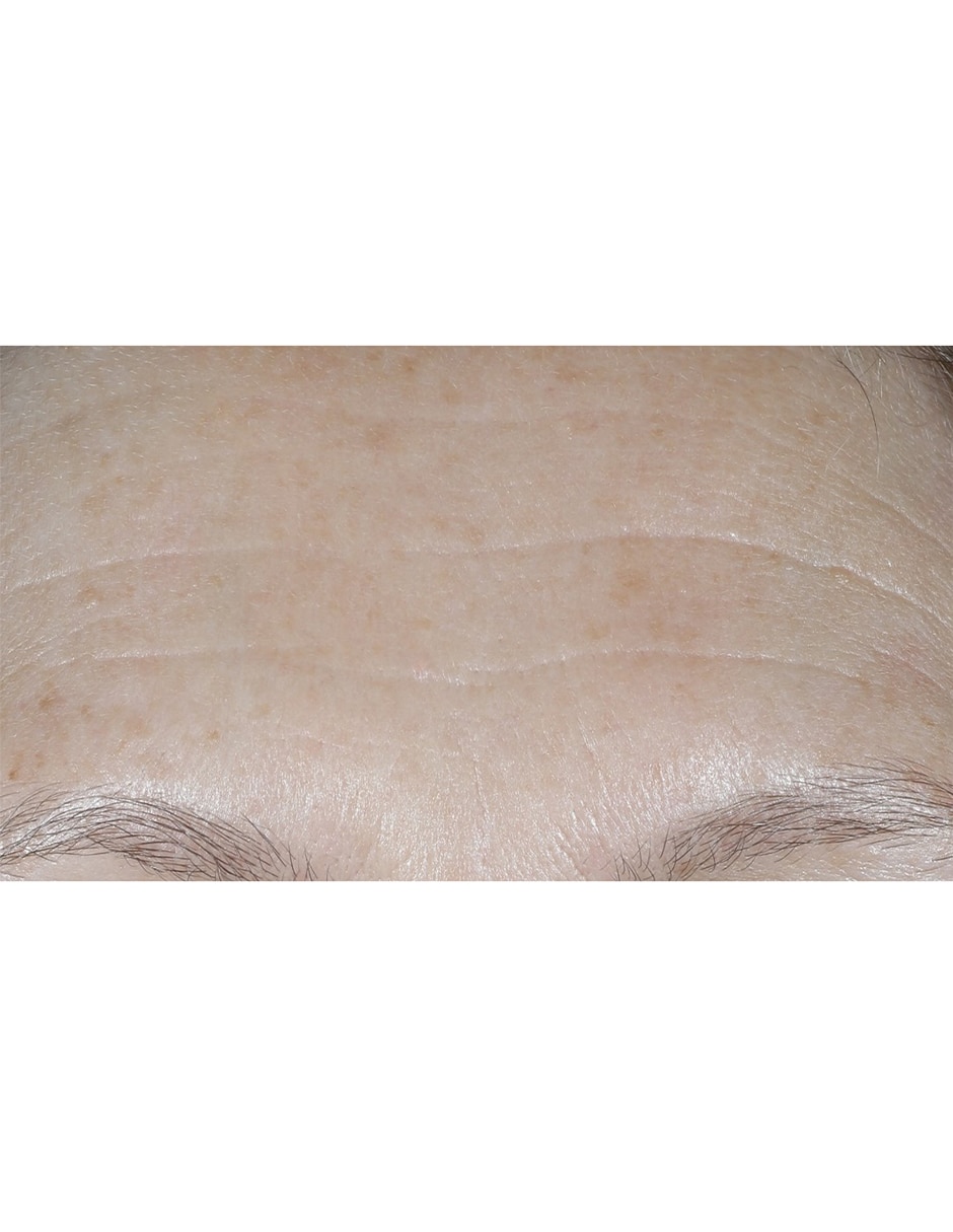 Crema facial recomendada para prevenir signos de la edad de día Smart Clinical Repair para todo tipo piel 14