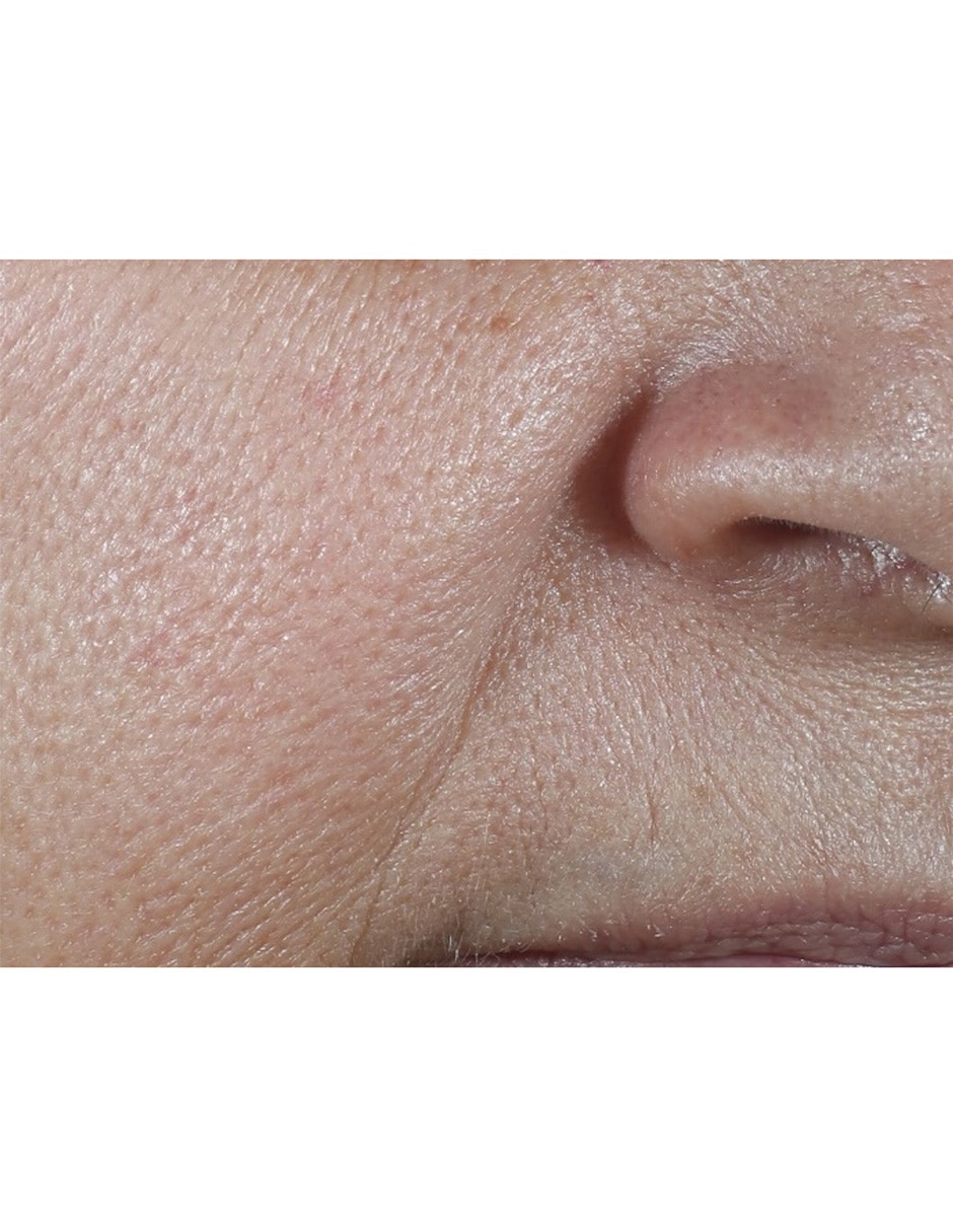 Crema facial recomendada para prevenir signos de la edad de día Smart Clinical Repair para todo tipo piel 15