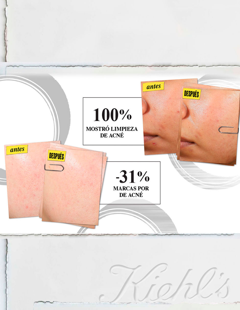 Hidratante facial Expertly Clear Moisturizer for Acne Prone Skin with Salicylic Acid