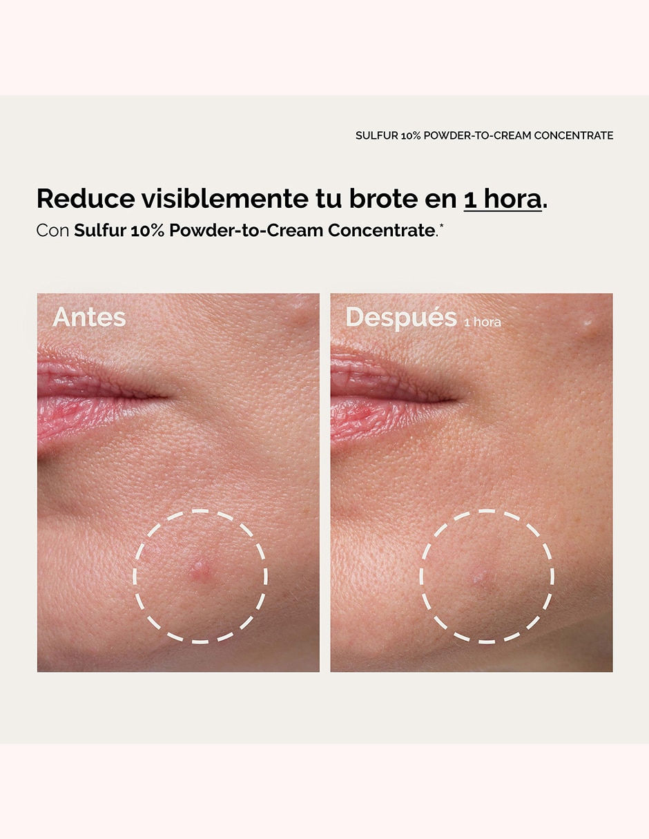 Tratamiento facial Sulfur 10% Powder-To-Cream Concentrate antiacné 7