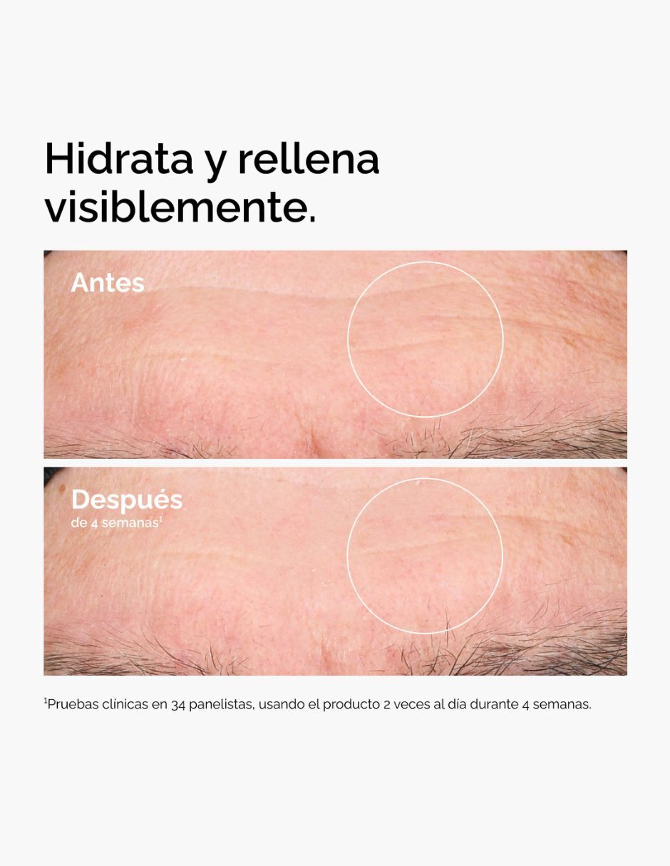 Tratamiento facial Hyaluronic Acid Tratamiento facial Hyaluronic Acid