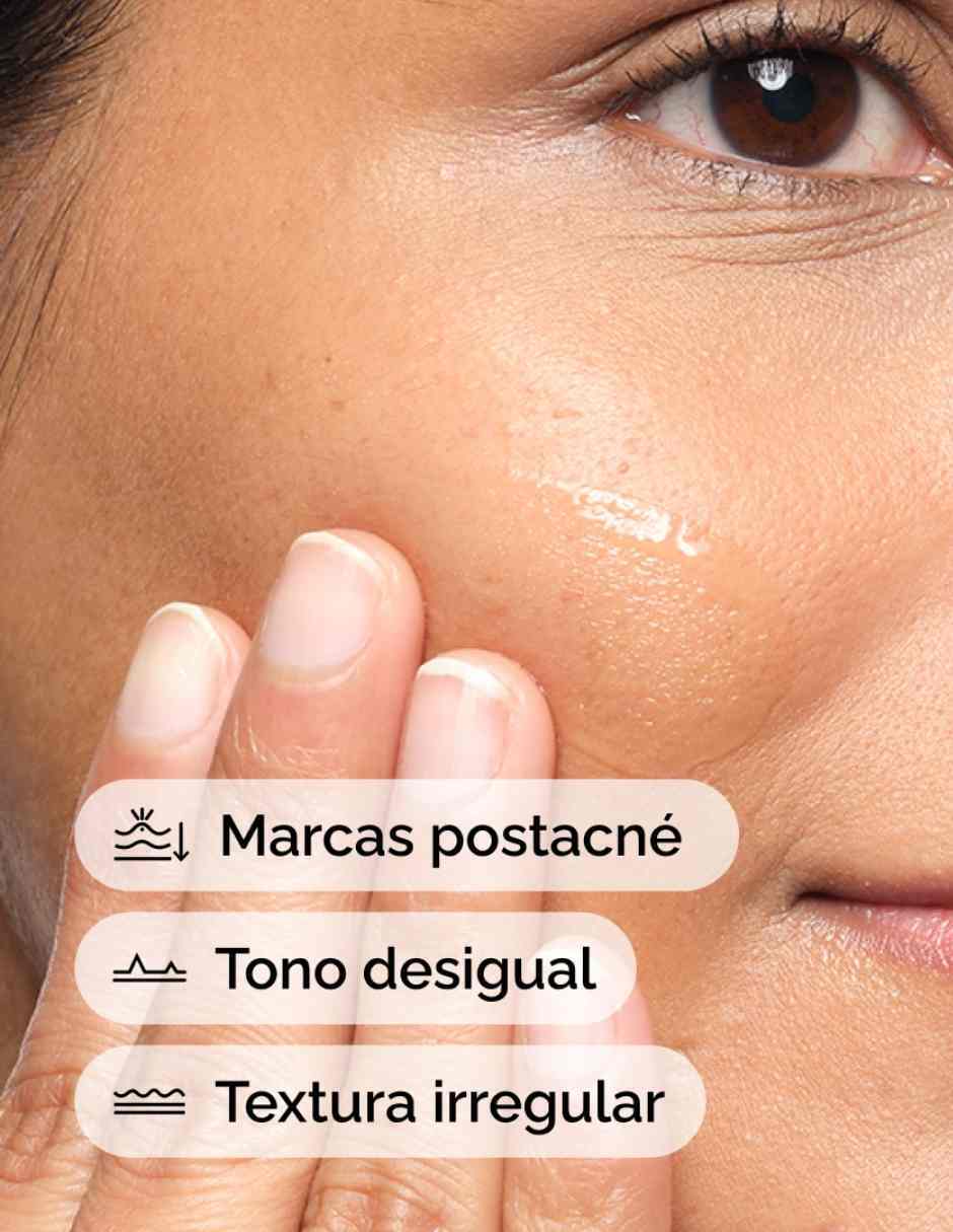 Sérum facial Aloe 2% + Nag 2% Solution (Solución de Aloe 2% + Nag 2% ) todo tipo piel 2