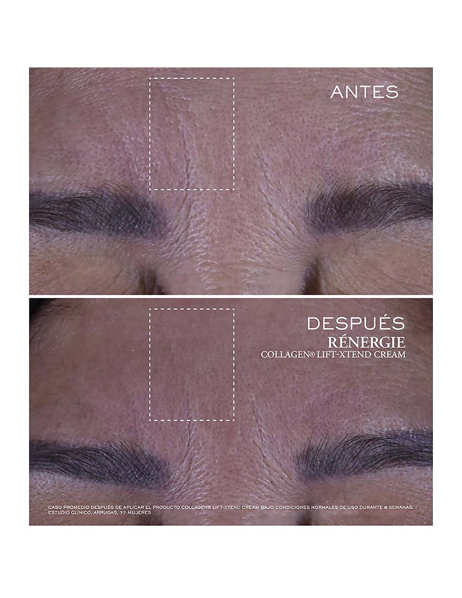 Set de crema para facial recomendada para prevenir signos de la edad de día y noche lancªme rénergie para todo tipo piel 3