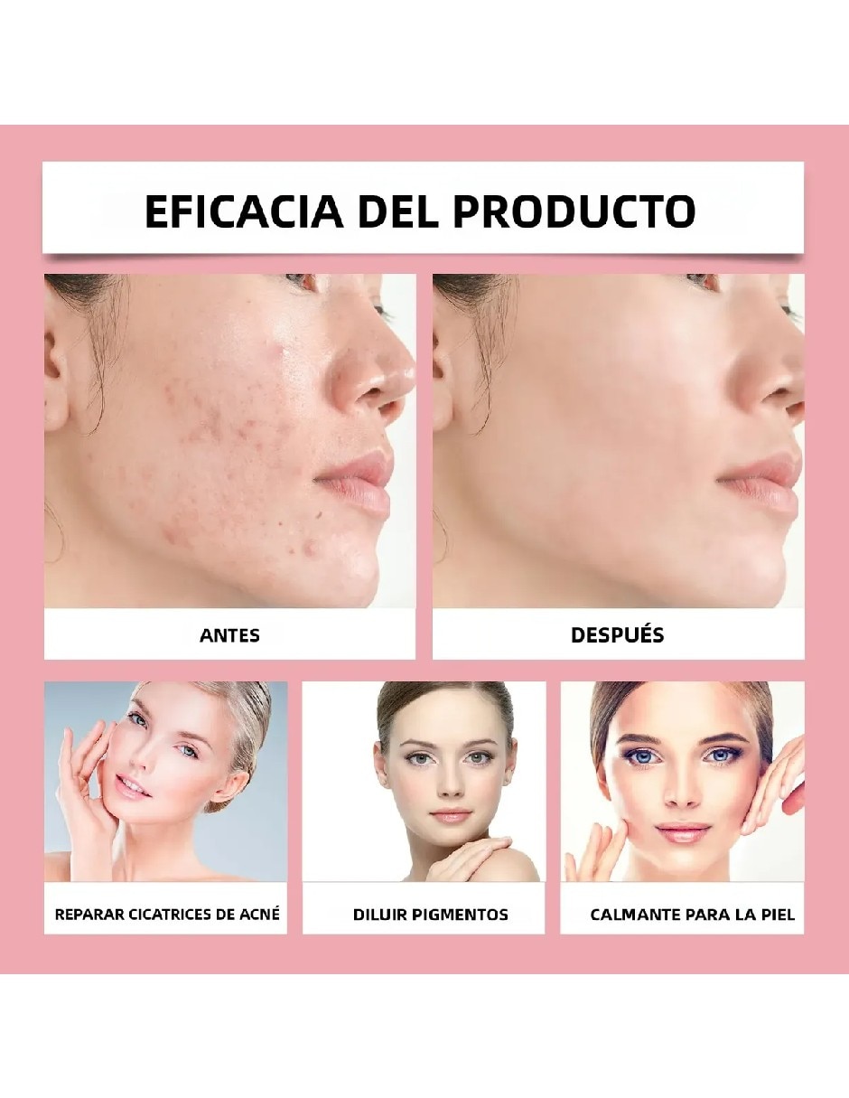 Sérum antiacné facial con niacinamida de todo tipo de piel