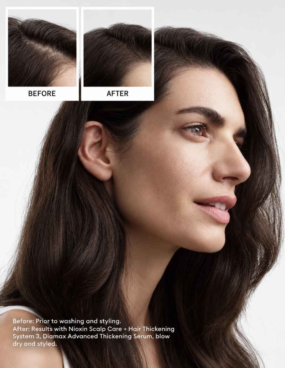 Tratamiento para cuero cabelludo Sistema 3 para cabello coloreado con debilitamiento ligero anticaída 2